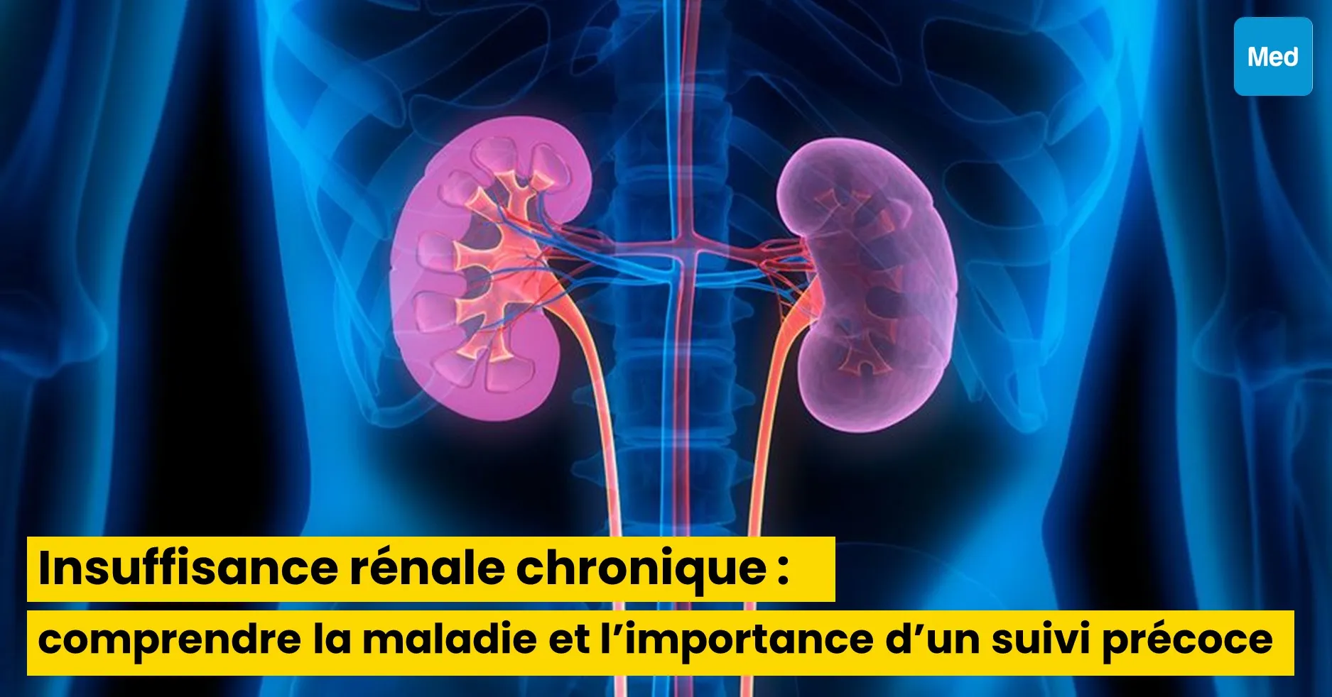 Insuffisance rénale chronique : comprendre la maladie et l’importance d’un suivi précoce chez le néphrologue